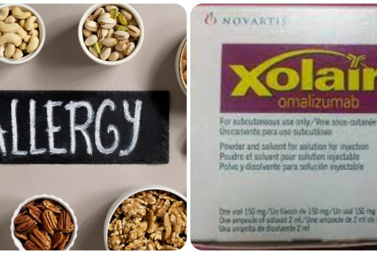 Visual Representation for food allergy and xolair