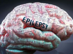 New Brain Surgery for Epilepsy Reduces Seizures